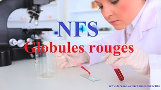 NFS Globules rouges [upl. by Annaehs]