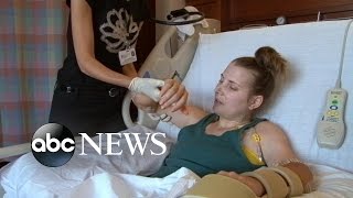 Lindsay Ess Story Part 1 Quadruple Amputee Undergoes Double Hand Transplant Surgery [upl. by Limemann]