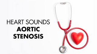 Aortic Stenosis  Heart Sounds  MEDZCOOL [upl. by Samson687]