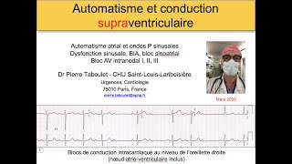 4a Les blocs supraventriculaires ECG Dr Taboulet [upl. by Venetia]