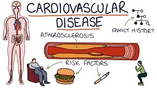 Understanding Cardiovascular Disease Visual Explanation for Students [upl. by Cassius839]