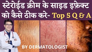 Steroid Cream side effects Treatment  कैसे ठीक करे  Top 5 QampA for Steroid Cream Side Effects [upl. by Millar]