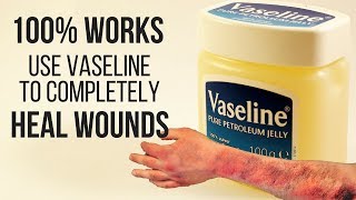 100 WORKS USE VASELINE TO COMPLETELY HEAL WOUNDS [upl. by Yltnerb]