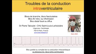 4b Les blocs intraventriculaires Bloc de branche BAV Dr Taboulet [upl. by Lefty432]