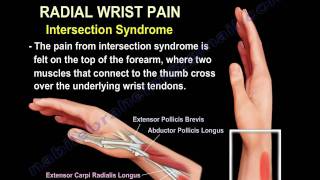 Wrist Paincauses and treatmentPart 2  Everything You Need To Know  Dr Nabil Ebraheim [upl. by Boor]