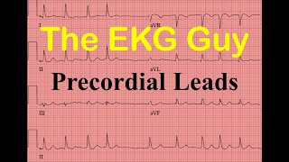 EKGECG Precordial Leads  Question 110  The EKG Guy [upl. by Zischke]