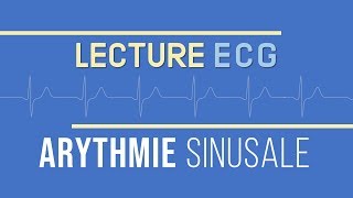 Interprétation ECG  Arythmie Sinusale [upl. by Ymmor423]