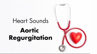 Aortic Regurgitation  Heart Sounds  MEDZCOOL [upl. by Netsuj719]