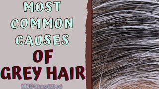 MOST COMMON CAUSES OF GREY HAIR [upl. by Lever]