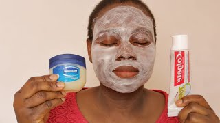 I APPLIED COLGATE TOOTHPASTE AND VASELINE ON MY FACE TO SEE WHAT HAPPENED [upl. by Blalock]