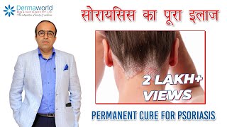 सोरायसिस का पूरा इलाज  Permanent Cure for Psoriasis  Dr Rohit Batra  In Hindi [upl. by Florette]