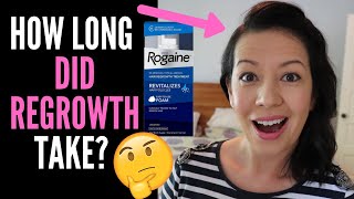 WHAT TO EXPECT WHEN STARTING ROGAINE OR MINOXIDIL HOW LONG DOES IT TAKE TO WORK And Weddings Talk [upl. by Assital]