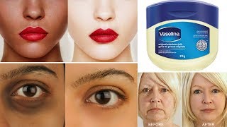 Top 3 Ways To Use Vaseline  Get Fair amp Glowing Skin  Removes Dark Spot Aging Signs amp Dark Circles [upl. by Sluiter]