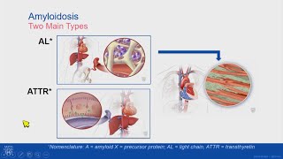 The Five Causes of Macular Degeneration in Detail Dr Alan Mendelsohn [upl. by Juster998]